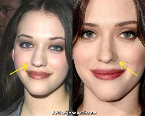 Kat Dennings Plastic Surgery Photos [Before & After]